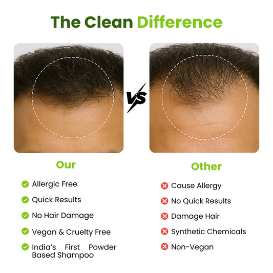 Buy 1 Get 1 FREE Shampoo with Reetha, Shikakai & Amla 200ML